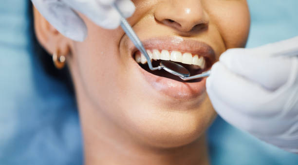 Best Urgent Care for Lost Fillings or Crowns in Windom, MN